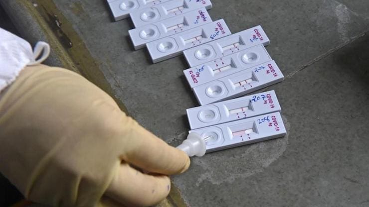 Mauritanie : la priorité dans les tests est donnée aux personnes présentant des symptômes de la maladie