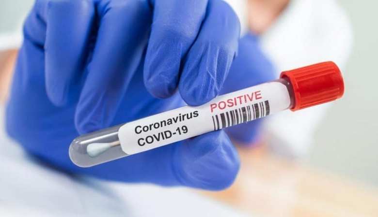 La situation épidémiologique du covid en Mauritanie : hausse sensible du nombre de cas au cours des dernières 24h